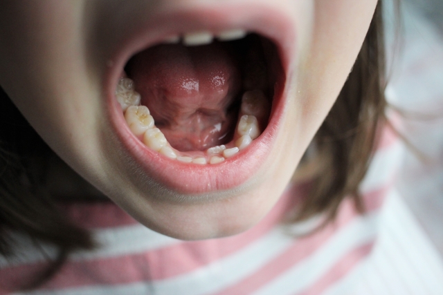 大きく口を開けた写真
